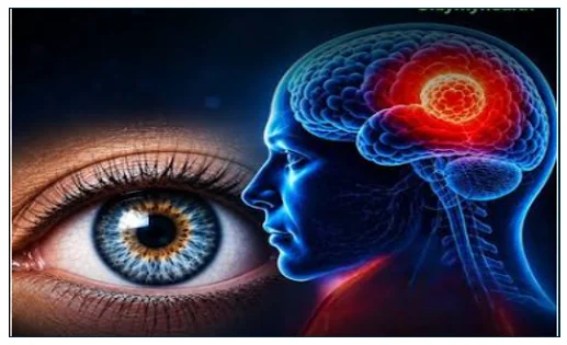 brain tumor 